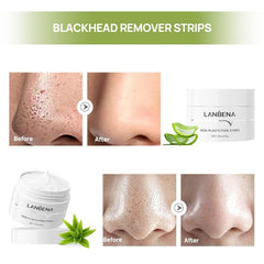 LANBENA Blackhead Mask With 60 Pcs Strips